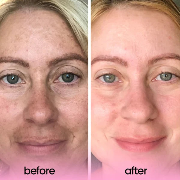 Kojic Acid & Turmeric Cleansing Pads (40 Pieces)